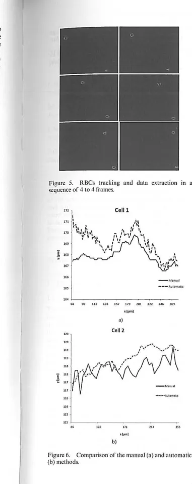 Figure  5.  RBCs  tracking  and  data  extraction  in  a  sequence of 4 to 4 fmmes.  m  CeUl  '"  - " _""l""'.U<  '" I--- - - -_--_--.-____  ~~--  -'"  '"  ~  ~  11 )  m  lU  In  rol  nl  Pti  l ~ _hun] o) CeJl2  - l 