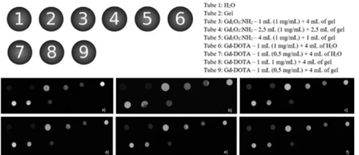 Fig. 5: Images obtained in SPIN-ECHO T1 sequence of eppendorf tubes  with varied contents, sequences and concentrations