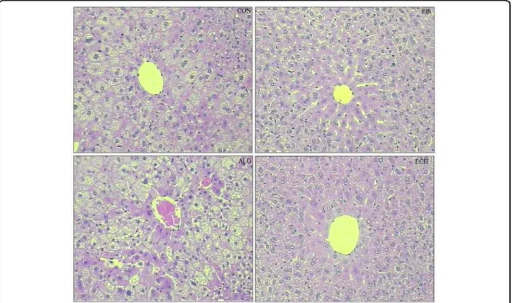 Figure 1 Representative photomicrographs of liver sections: (CON) - fatty infiltration around the portal space; (FIS) and (ECH) -  antisteatogenic effect exhibiting well-defined cells and low-fat vacuoles in the cytoplasm, and (ALG): hepatocytes presenting