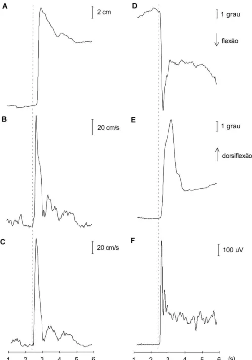 Figura 2: Centro de pressão anteroposterior; B. Velocidade da bandeja; C. Velocidade do tronco; D