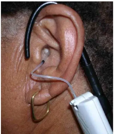 Figura 7 - Posicionamento do tubo sonda no conduto auditivo externo 