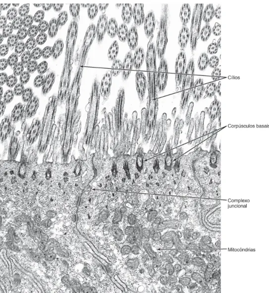 Figura 3. Elétron-micrografia de células ciliadas. Observe os microtúbulos dos cílios  cortados transversal e obliquamente