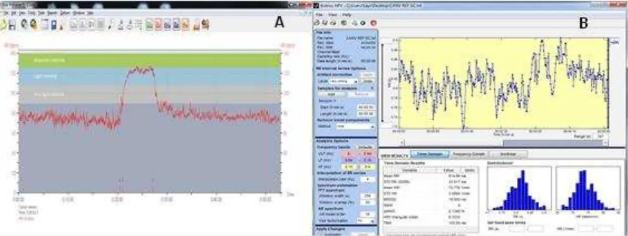 Figura  7.  Software  Polar  ProTrainer  5  utilizado  para  armazenar  e  filtrar  o  registro  obtido  por  meio  do  PolarS810i  e  Software  Kubios  HRV  Analysis  utilizado  para  analisar  a  variabilidade  da  frequência  cardíaca:  (A)  Tacograma  