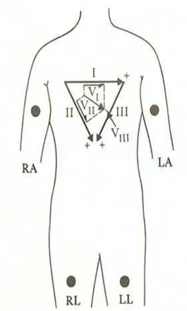 Figura 3.6 – Triângulo de Einthoven e as derivações principais I, II e III [25]. 