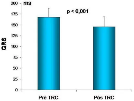 Figura 9. Diagrama de barras mostrando o efeito da terapia de  ressincronização cardíaca (TRC) na duração do complexo QRS na  população total do estudo, n = 30 