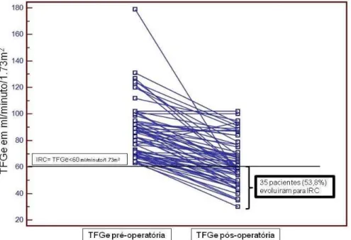 Figura 7  –  Diagrama Dot &amp; line demonstrando evolução individual pré e pós- pós-operatória  da  taxa  de  filtração  glomerular  estimada  (TFGe)  em  ml/minuto/1.73m 2  e pacientes que evoluíram para insuficiência renal crônica  (IRC) após a nefrecto