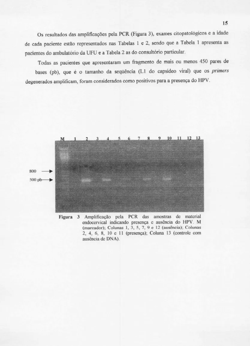 Figura 3 Amplificação pela PCR das amostras de material endocervical indicando presença e ausência do HPV