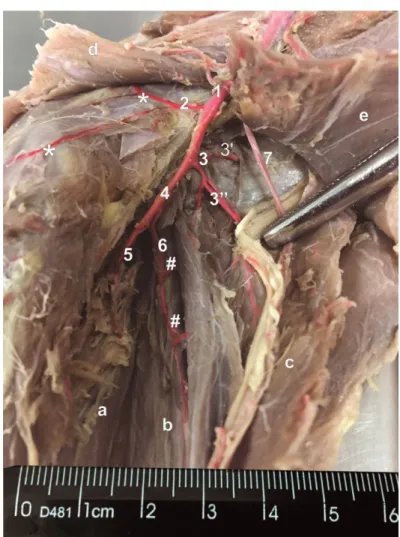 Figura 1 - Vista medial da perna direita de um exemplar de javali (Sus scrofa). [1] artéria femoral, [2] artéria  descendente do joelho, [*] ramos musculares;  [3] femoral caudal [3’] ramo ascendente, [3’’] ramo 