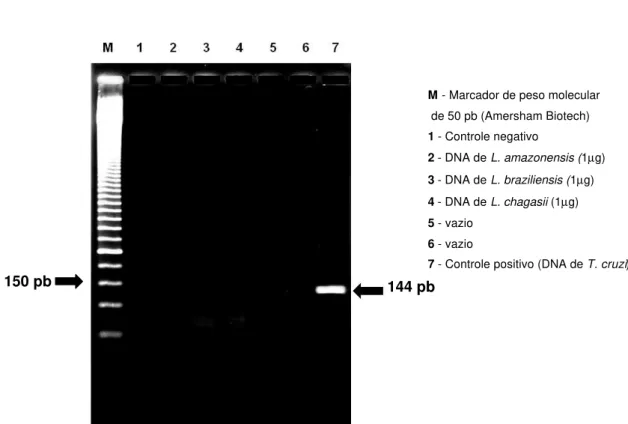 Figura 5 -  Teste de especificidade dos oligonucleotídeos iniciadores da seqüência TCZ com o DNA de L