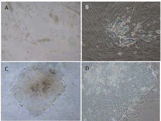 Figura  5:  Diferentes  períodos  durante  a  reprogramação  celular  in  vitro  de  hAdMSC.  A:  10  dias  pós  transdução.  100X.  B:  15  dias  pós‐transdução.  200x.  C  e  D:  colônia  iPS  após  repique  manual, 40x e 200X, respectivamente. 