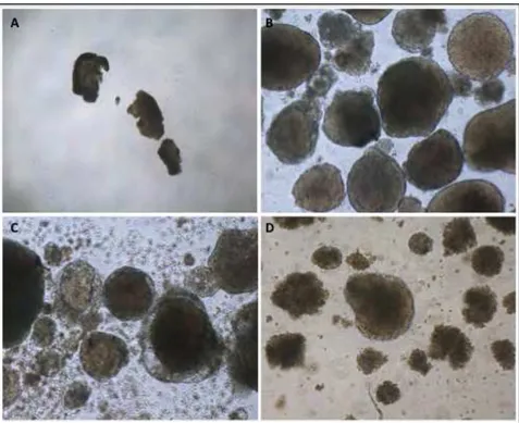 Figura 11: Formação de corpos embrioides antes do repique (A) e após cultivo em agarose (B, C  e D). B: hiPS 2 p18. C: hiPS 3 p11. D: hiPS 4 p17. 100x. 
