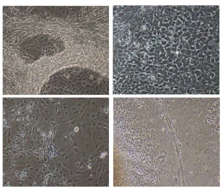 Figura  12:  Diferentes  tipos  celulares  encontrados  no  cultivo  de  corpos  embrioides  em  gelatina  após 9 dias em cultivo. Linhagem hiPS2. 200x. 