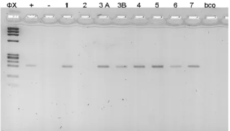 Figura 13: A imagem representa a amplificação do fragmento de 200pb do gene eGFP  inserido no genoma celular