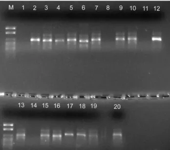 Figura 3: Produtos de amplificação gerados pelo  primer OPA15 (M) Marcador  100  pb  DNA  Ladder;  (UFU-01  ao  UFU-20)  linhagens  analisadas