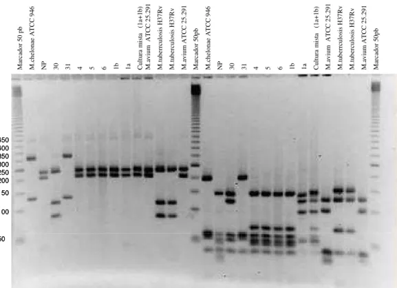 Figura 2 – Perfis de PRA hsp65 de 09 isolados e cepas ATTCs de Mycobacterium  chelonae,  M