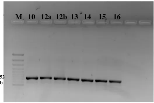 Figura 5 - Amplificação de um fragmento do gene rpoB de 752 pb para  seqüenciamento. M: marcador de 100pb 