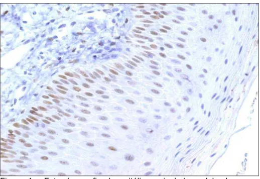 Figura 1 - Fotomicrografia do epitélio vaginal de cadela do grupo  controle em proestro, mostrando a distribuição dos RE-D por imunoistoquímica (estreptavidina-biotina-peroxidase +  hematoxilina obj 20X) 