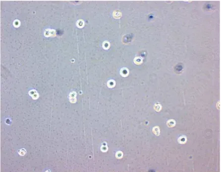 Figura  4 - Avaliação da viabilidade celular dos neutrófilos em microscopia óptica (40x),  utilizando azul de Trypan como corante: campo apresentando células viáveis (amarelas) e  inviáveis (azuis)