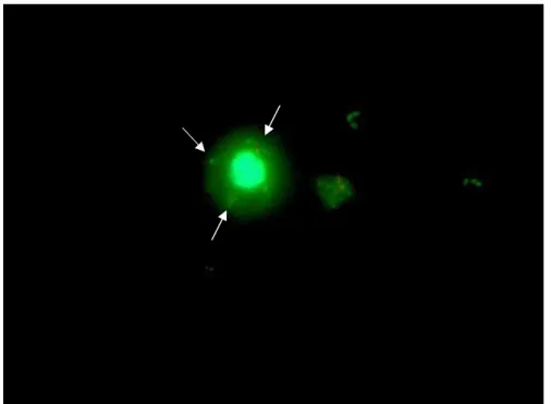 Figura  8 - Fagocitose: Neutrófilo apresentando cocos fagocitados . Microscopia de  fluorescência, utilizando a coloração com  acridine orange  (1000x)