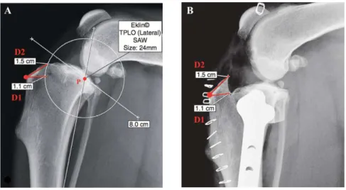 Figura 16 – A - Medição dos pontos D1 e D2 numa radiografia pré-cirúrgica; B - Confirmação dos pontos D1 e D2  numa radiografia pós-cirúrgica (adaptado de Tobias e Johnston 2012)