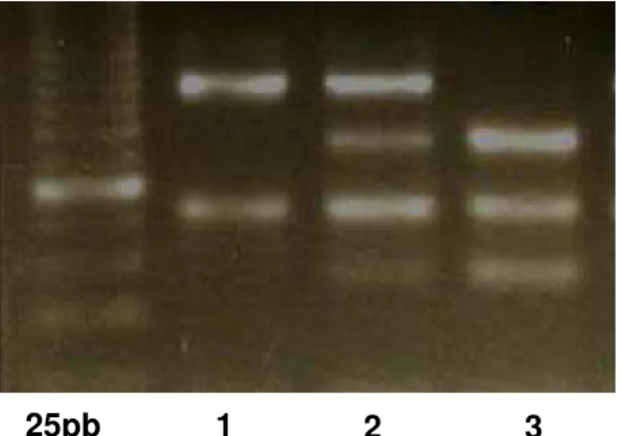 Figura 06 –  Gel de agarose 3,0% corado com brometo de etídeo, mostrando o  produto da digestão por PstI, o marcador de peso molecular utilizado  foi o de 25pb; em 1 temos as bandas de 224 e 100pb, o que  caracteriza o genótipo A/A (selvagem); em 2, visual