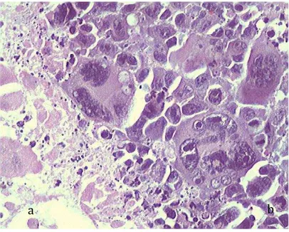 Figura 4 - Fotomicrografia de corte histológico do tumor de Ehrlich  