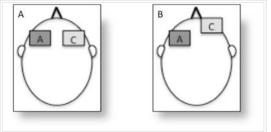 Figura 19.  (A) Ânodo colocado sobre área F3 e cátodo sobre F4, usado em nosso  estudo