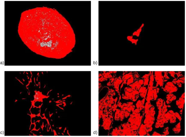 Figura  7  –  Determinação  de  porcentagem  de  área  imunomarcada  pelos  anticorpos  através  de  limiar  de  detecção  (threshold  –  máximo  da  escala  de  cinza  de  127)