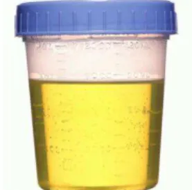 Figura 3 - Urina no frasco coletor universal 