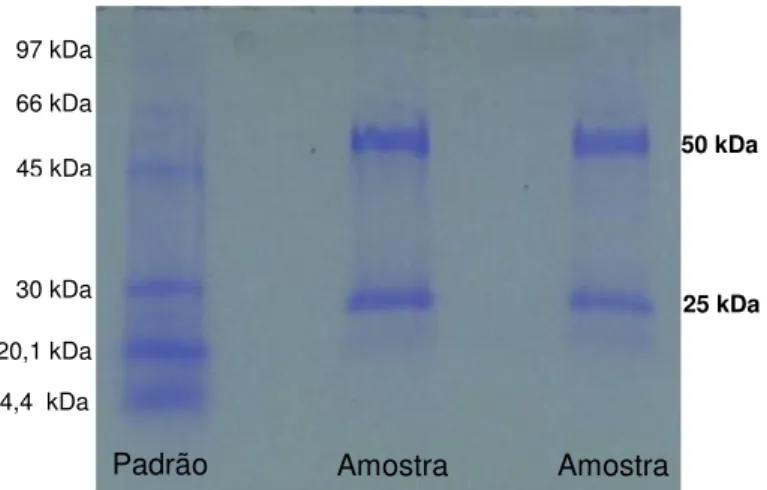 Figura 2. Perfil eletroforético (SDS-PAGE) da purificação de anticorpos policlonais contra glicolipídio  acídico por cromatografia de afinidade em coluna de proteína A 