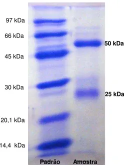 Figura  3.  Perfil  eletroforético  (SDS-PAGE)  da  purificação  de  anticorpos  policlonais  contra  BSA  (controle) por cromatografia de afinidade em coluna de proteína A 
