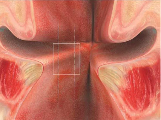 Figura 8. Representação gráfica esquemática da região interna da laringe após incisão  longitudinal entre as cartilagens aritenóides (visão posterior)