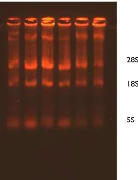 Figura  5.  RNAs  extraídos  de  amostras  de  HL-60  e  HL-60  BCR-ABL  cultivadas  na presença e ausência da LAAO e submetidos à eletroforese em gel red 1,5%