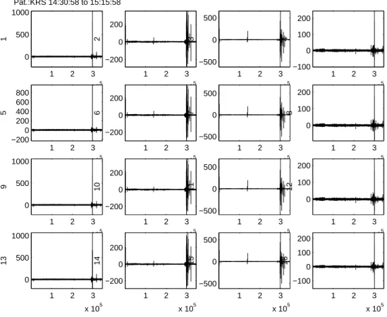 Figure 2: EEG plots of module-4 patient (k = 4)