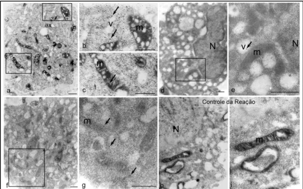 Figura 7 C – Expressão de Gal-3 nas células Melan-a. Na condição controle  (a-c), a expressão da Gal-3 (setas) foi intensa, observada no citoplasma,  mitocôndrias (m), membrana dos vacúolos (v) e núcleo (N)