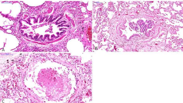 Figura 5. Fotomicrografias  (B),  H1N1(C).  Observe  em epitélio  descamado  e  a  corresponde a 100µm