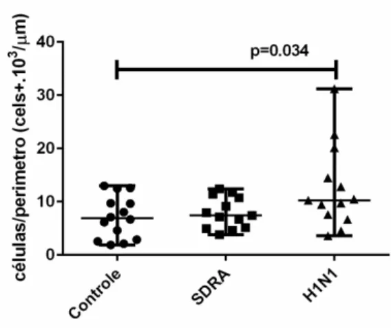 Gráfico 5. Densidade de gr SDRA e H1N1. Dados apre