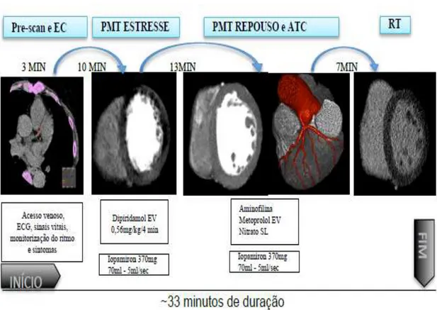 Figura  6:  Protocolo  de  perfusão  miocárdica  de  estresse  pela  tomografia  nos  pacientes  com  BRE