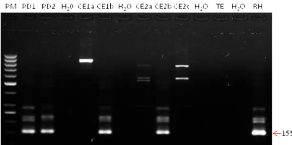 Figura  2  -  Nested-PCR  do  locus  B1,  em  gel  de  agarose  2%,  a  partir  da  amostra  primária  (pré-digestão  de  musculatura e cérebros) de morcegos dos quais foi isolado T