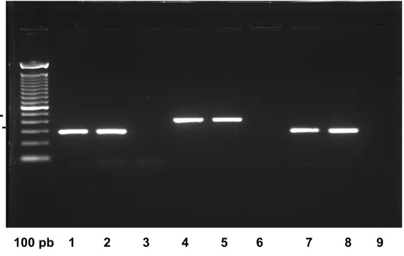 Figura 7: Foto representativa do produto da amplificação dos gene ABCG2.  