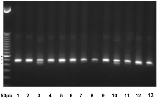 Figura  9:  Análise  do  genótipo  Val12Met  do  gene  ABCG2  por  Reação  em  Cadeia  de  Polimerase  –  Polimorfismo  do  tamanho  do  fragmento  de  Restrição