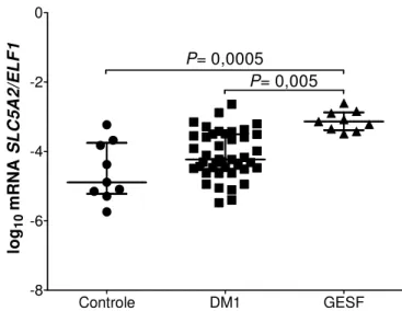 Figura  5  -  Expressão  relativa  do  gene  que  codifica  o  SGLT2  (SLC5A2/ELF1)  em  sedimento urinário de indivíduos controles, portadores de diabetes tipo 1 (DM1) e de  glomeruloesclerose segmentar e focal (GESF)