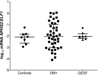 Figura  8  -  Expressão  relativa  do  gene  que  codifica  a  podocina  (NPHS2/ELF1)  em  sedimento  urinário  de  indivíduos  controles,  de  portadores  de  DM1  e  de  glomeruloesclerose segmentar e focal (GESF)