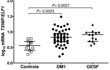 Figura  10  -  Expressão  relativa  do  gene  que  codifica  a  TXNIP  (TXNIP/ELF1)  em  sedimento  urinário  de  indivíduos  controle,  de  portadores  de  DM1  e  de  glomeruloesclerose segmentar e focal (GESF)