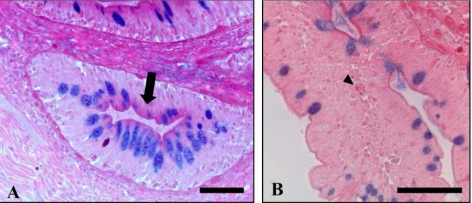 Figura 11 – Fotomicrografias do intestino médio de pintado. A – Glândula intestinal (seta) visualizada  no sétimo  segmento do intestino médio, apresentando células caliciformes coradas  pelos métodos histoquímicos