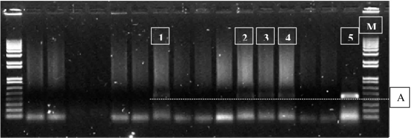 Figura 13 - Amplificação do fragmento de cDNA dos isolados de ToCV, amostras dos campos em  Sumaré, 2009 – 2011 