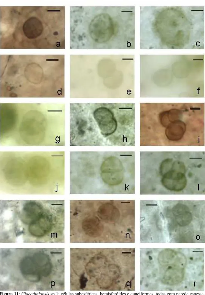 Figura 11: Gloeodiniopsis sp 1: células subesféricas, hemisferóides e cuneiformes, todas com parede espessa