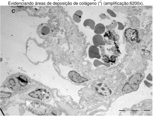 Figura 7  –  Microscopia Eletrônica do grupo Alta Pressão 