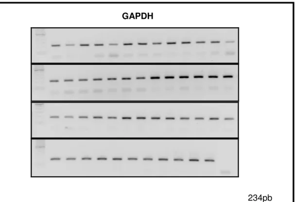 Figura  9  –   Eletroforese  em  gel  de  agarose  das  amostras  amplificadas  por  RT-PCR para o primer GAPDH 