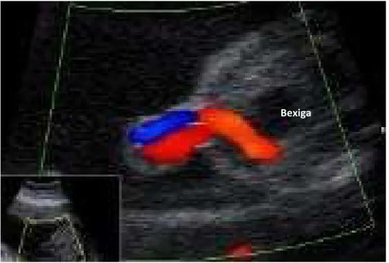 Figura 8 -   Corte transversal da pelve fetal, no segundo trimestre da  gestação, no nível da bexiga urinária